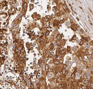 BDH1 Antibody - BSA Free
