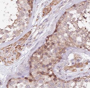 BCMO1 Antibody - BSA Free
