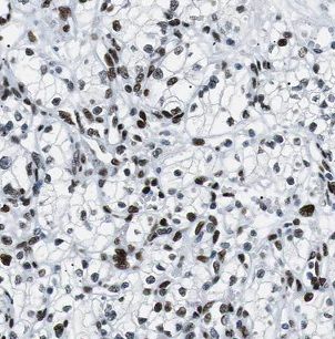 BCKDHB Antibody - BSA Free