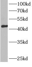 BCAT1 Antibody - BSA Free