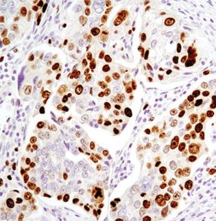 BBX Antibody - BSA Free