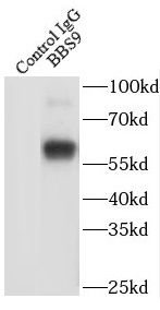 BBS9 Antibody - BSA Free