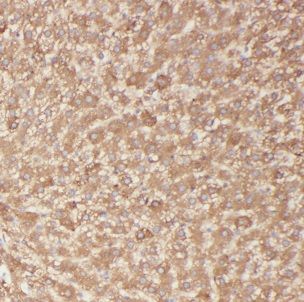 BBS9 Antibody - BSA Free