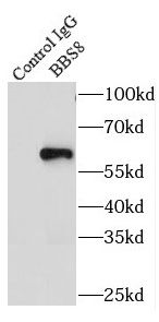 TTC8 Antibody - BSA Free