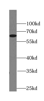 MKKS Antibody - BSA Free