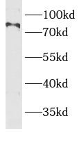 BBS10 Antibody - BSA Free