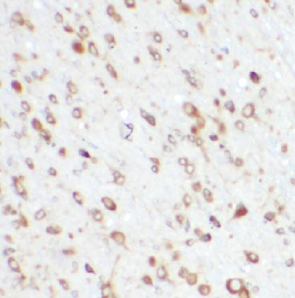 BBS1 Antibody - BSA Free