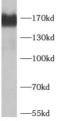 SMARCC2/BAF170 Antibody - BSA Free