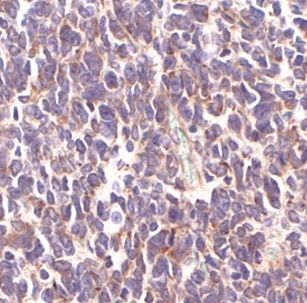SMARCC2/BAF170 Antibody - BSA Free