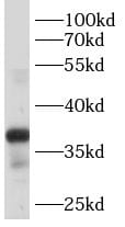 B4GALT7 Antibody - BSA Free