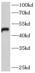 B4GALT6 Antibody - BSA Free