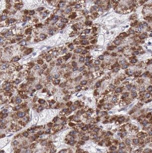 B4GALT3 Antibody - BSA Free