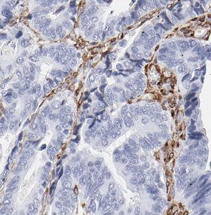 beta-1,4-Galactosyltransferase 2/B4GalT2 Antibody - BSA Free