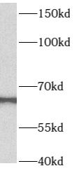 B4GALNT2 Antibody - BSA Free