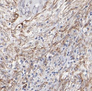 B4GALNT2 Antibody - BSA Free