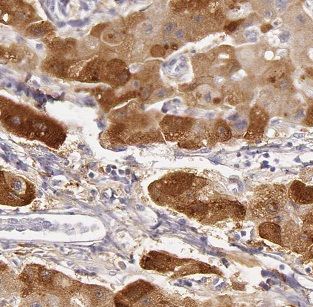 B3GALT6 Antibody - BSA Free
