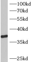 B3GALT6 Antibody - BSA Free