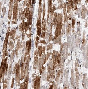 B3GALT2 Antibody - BSA Free