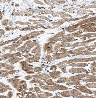 B3GALNT2 Antibody - BSA Free