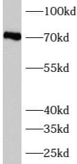 AUTS2 Antibody - BSA Free