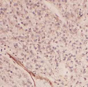 Ancient ubiquitous protein 1 Antibody - BSA Free