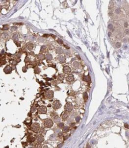 Ataxin-2-like protein Antibody - BSA Free