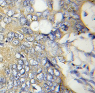 ATPAF2 Antibody - BSA Free