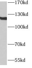 ATP8A1 Antibody - BSA Free