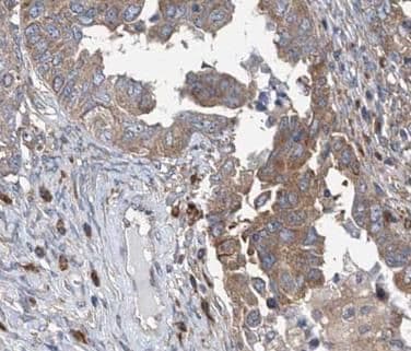 ATP6V1C1 Antibody - BSA Free