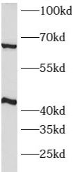 ATPase Na+/K+ beta 2 Antibody - BSA Free