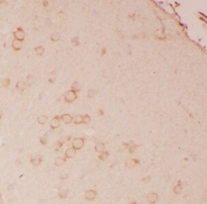 ATPase Na+/K+ beta 2 Antibody - BSA Free