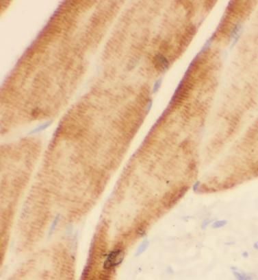 Sodium Potassium ATPase Alpha 2 Antibody - BSA Free