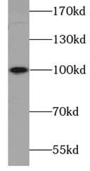 Sodium Potassium ATPase Alpha 2 Antibody - BSA Free