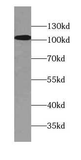 ATP13A1 Antibody - BSA Free
