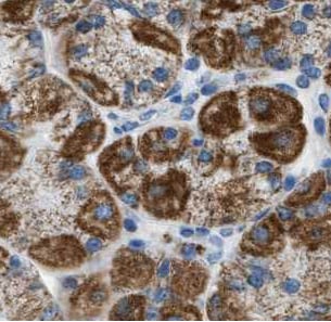 ATP11B Antibody - BSA Free