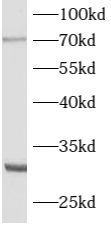 ATG16L2 Antibody - BSA Free