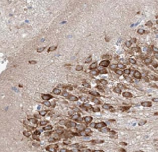ATF6 beta Antibody - BSA Free