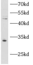 ATAD1 Antibody - BSA Free