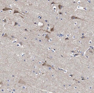 ASTN2 Antibody - BSA Free