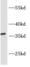 ASPRV1 Antibody - BSA Free