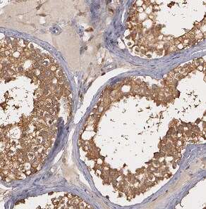 ASB17 Antibody - BSA Free
