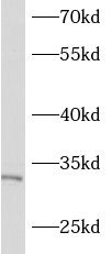 ASB17 Antibody - BSA Free