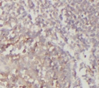 ASB-14 Antibody - BSA Free