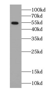 ARSK Antibody - BSA Free