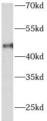 ARRDC3 Antibody - BSA Free