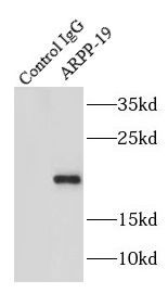 ARPP19 Antibody - BSA Free