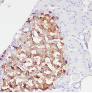 ARMC7 Antibody - BSA Free