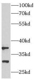 ARMC10 Antibody - BSA Free
