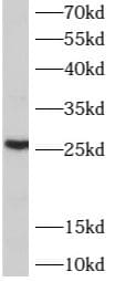 ARL6IP6 Antibody - BSA Free