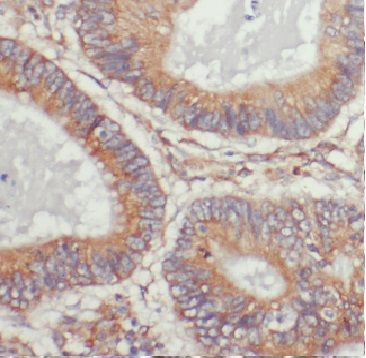 ARL4C Antibody - BSA Free